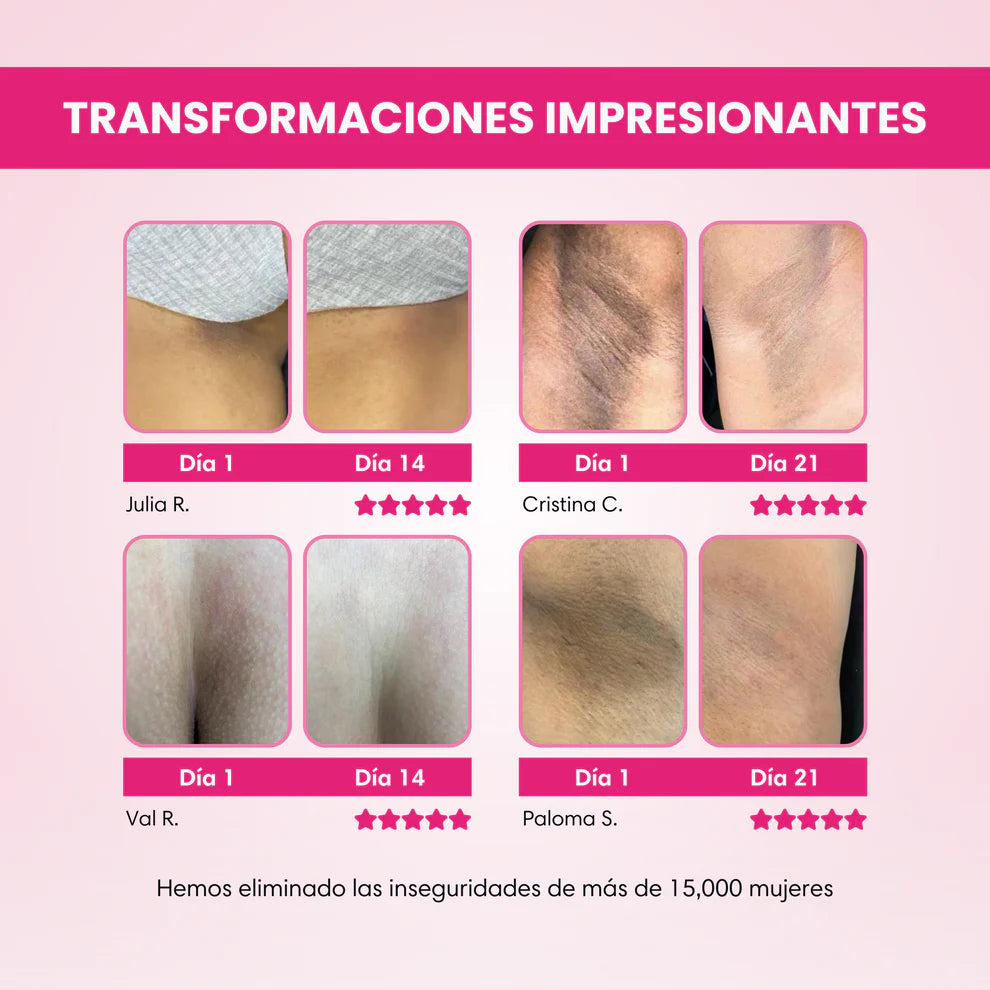 ✨ Crema Aclarante Skinglow®