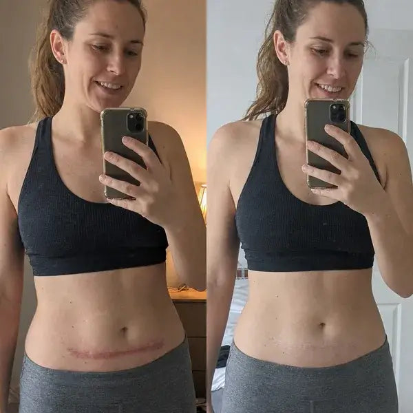 Gel Removedor de Cicaticres Tryskintle