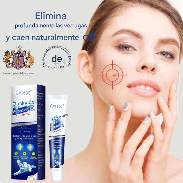 Crema de tratamiento de verrugas corporales para eliminación de verrugas Cvreoz®