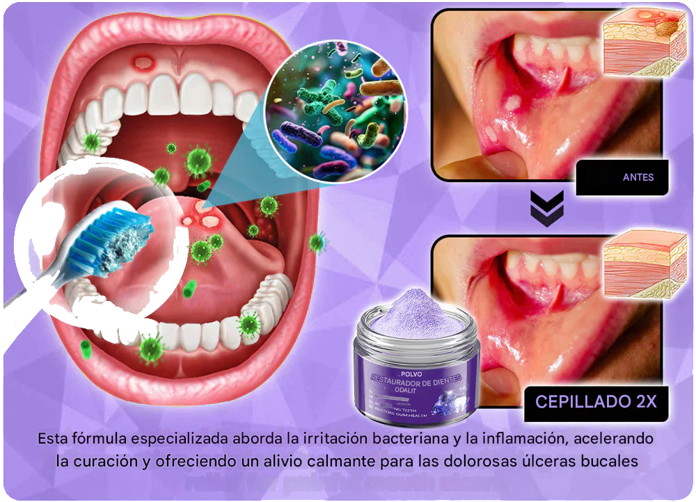 Polvo mineral para la restauración de dientes ODALIT™🦷