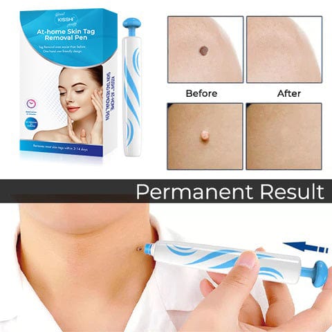 KIT para eliminar verrugas cutáneas en casa KISSHI™