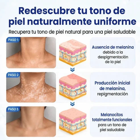 VitiRepair - Spray avanzado para el vitiligo y parches blancos