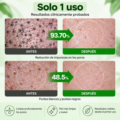🔥PROMO 2X1 🔥Nueva GREEN TOMATO™ - Limpieza Profunda De Poros Y Puntos Negros ✨