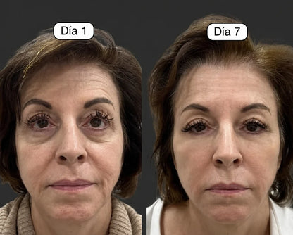 Cepillo Facial Drenaje Linfatico Masajeador 🪮