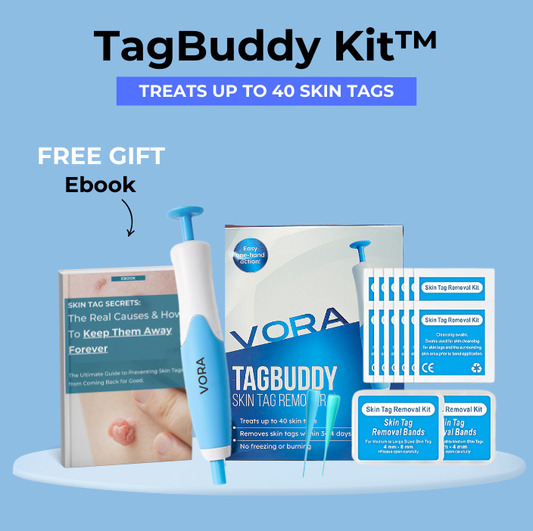 TagBuddy Kit - No Mas Verrugas