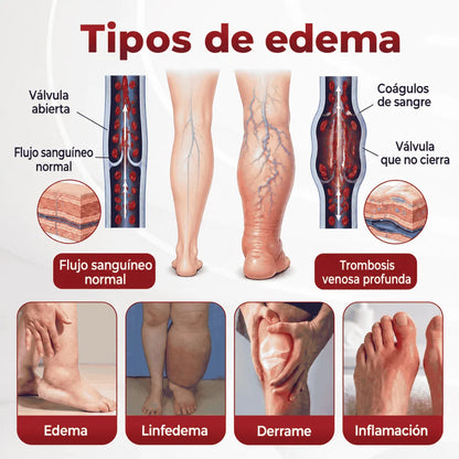 SwellVeil - Crema para la circulación de piernas