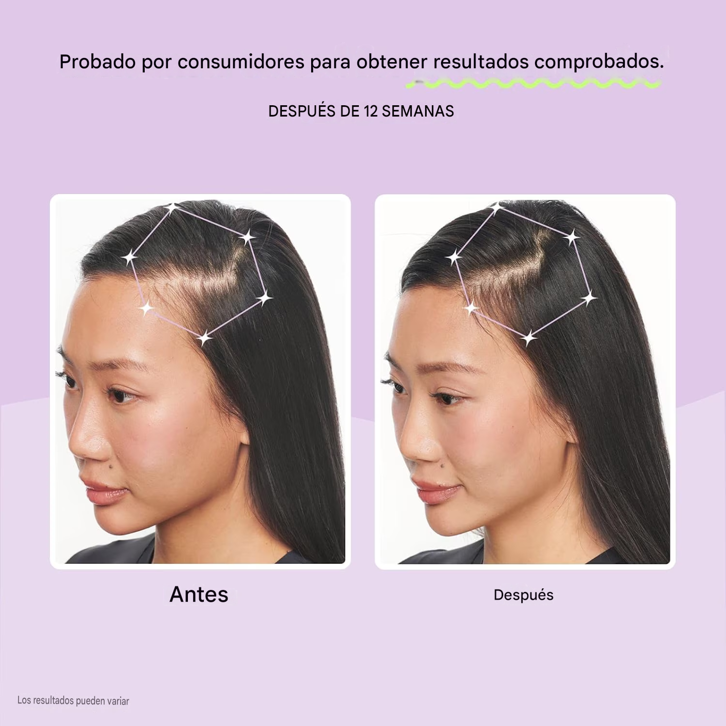 Cápsulas Lemme Grow para el crecimiento del cabello y para combatir la caída, 60 unidades.