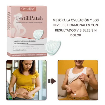 Sistema de mejora de la fertilidad con microagujas Oveallgo® FertiliPatch