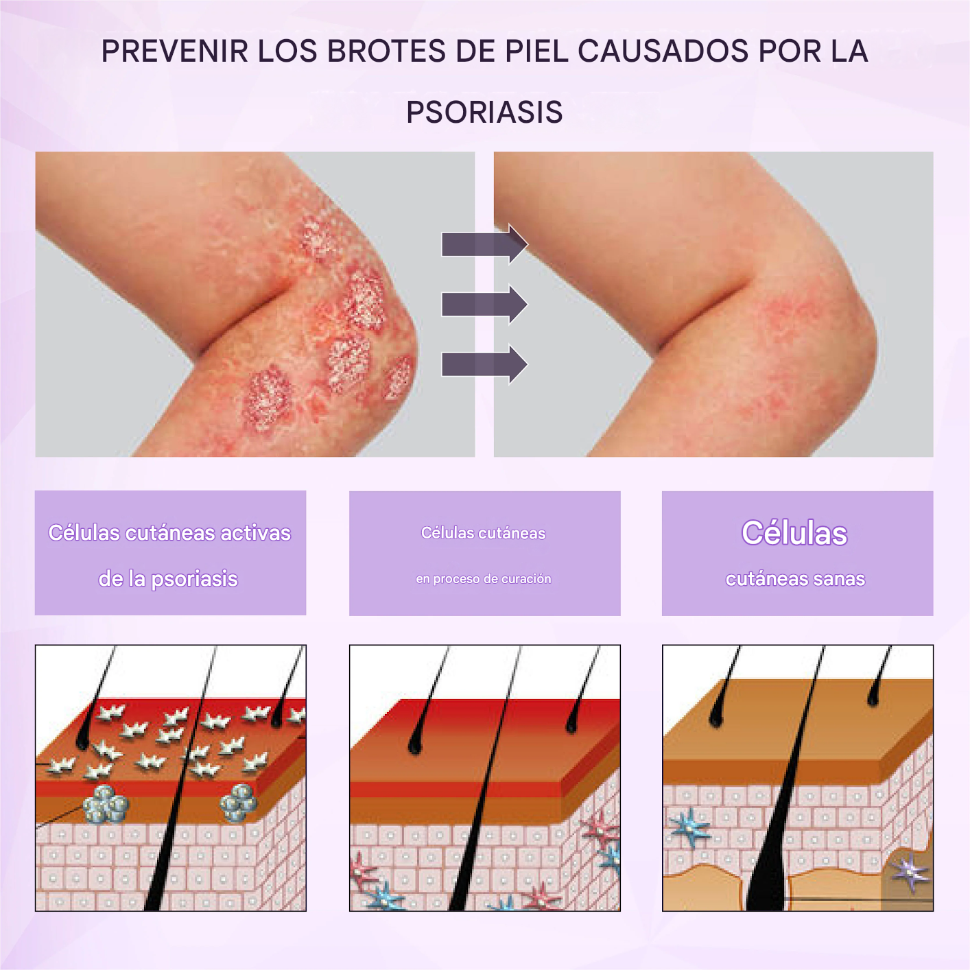 Spray multiusos para la piel Fivfivgo® de maíz morado