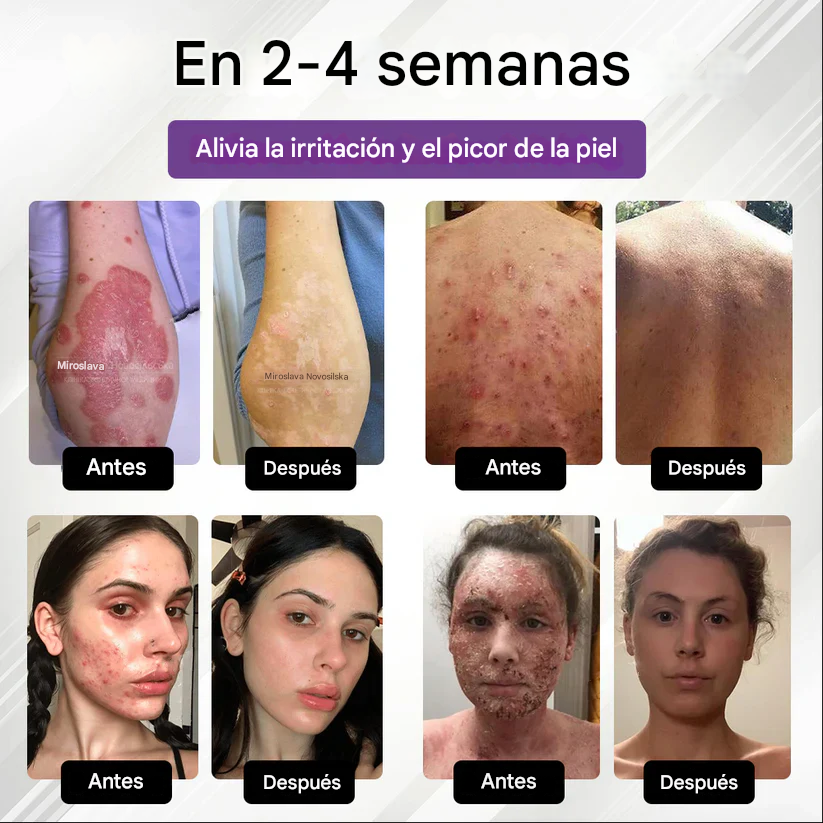 Spray multiusos para la piel Fivfivgo® de maíz morado