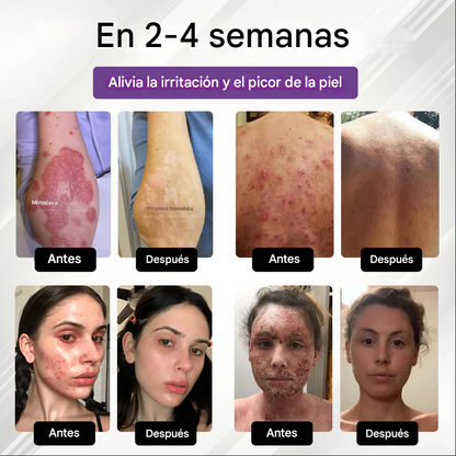 Spray multiusos para la piel Fivfivgo® de maíz morado