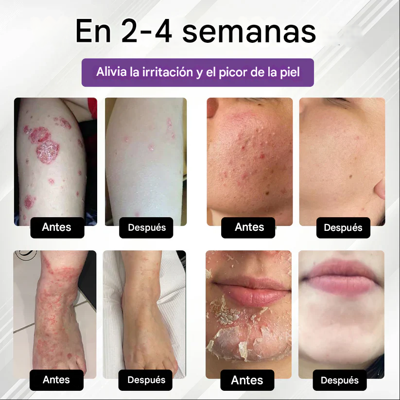 Spray multiusos para la piel Fivfivgo® de maíz morado