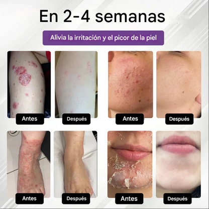 Spray multiusos para la piel Fivfivgo® de maíz morado