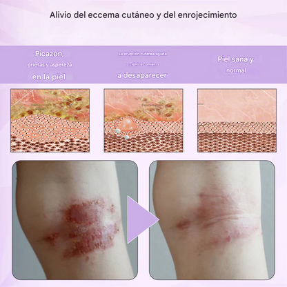 Spray multiusos para la piel Fivfivgo® de maíz morado