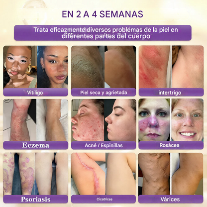 QIAWI® Biotina Crema Restauradora de la Piel 10 en 1 🍀