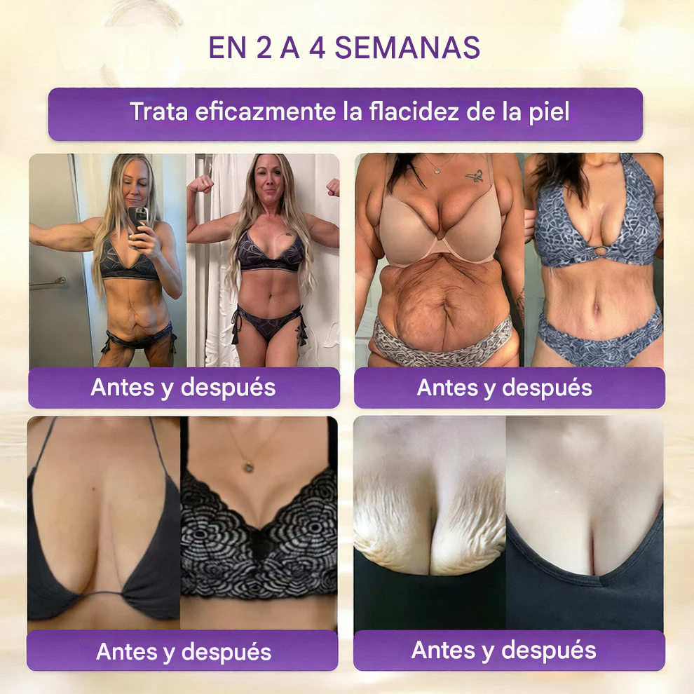QIAWI® Biotina Crema Restauradora de la Piel 10 en 1 🍀