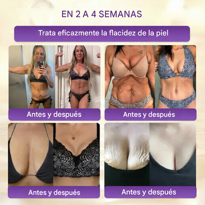 QIAWI® Biotina Crema Restauradora de la Piel 10 en 1 🍀