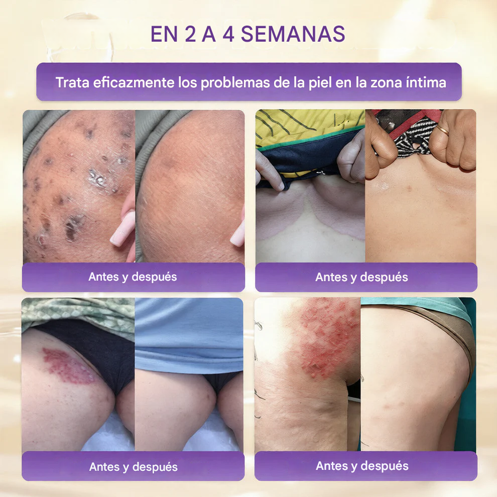 QIAWI® Biotina Crema Restauradora de la Piel 10 en 1 🍀
