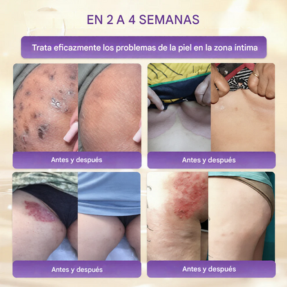 QIAWI® Biotina Crema Restauradora de la Piel 10 en 1 🍀
