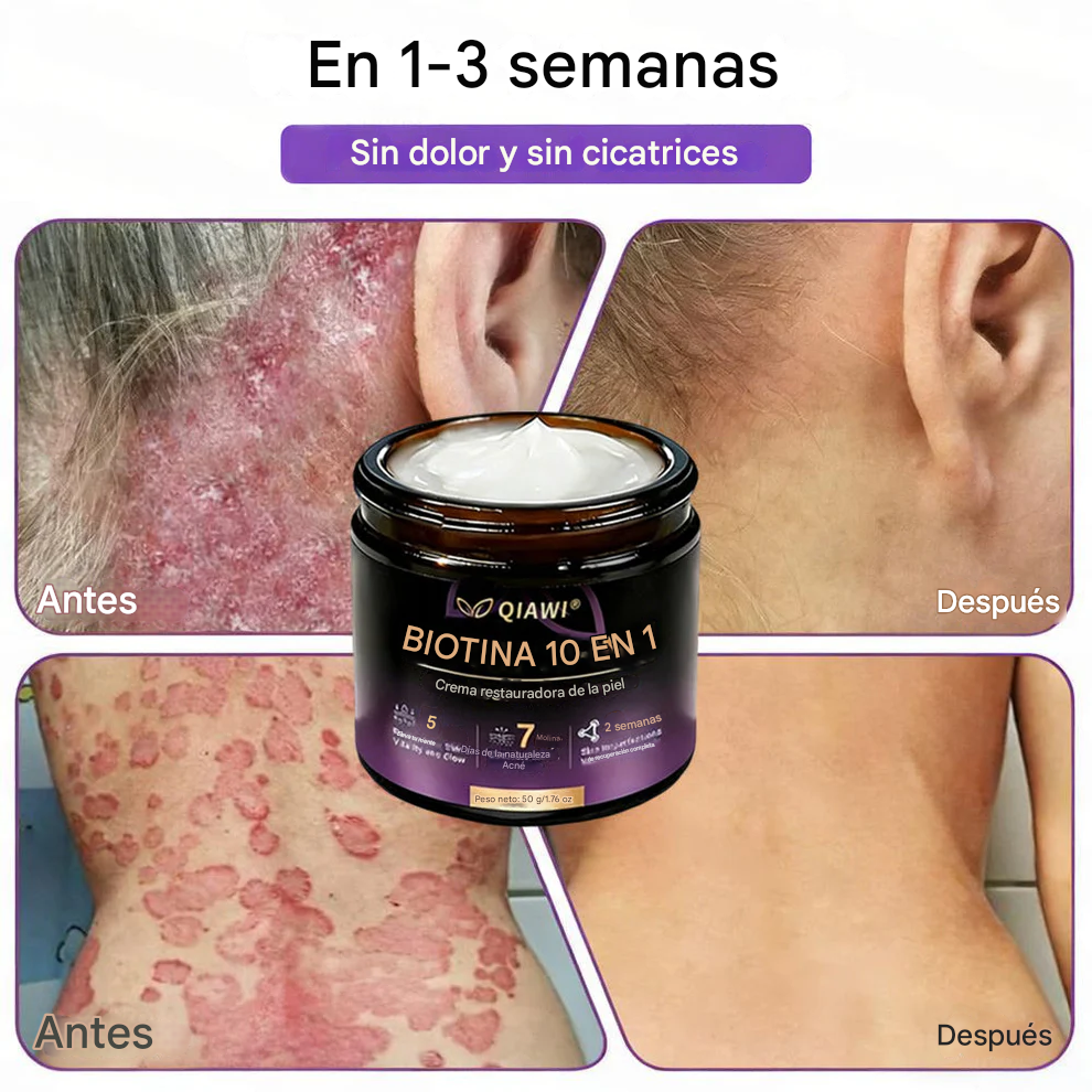 QIAWI® Biotina Crema Restauradora de la Piel 10 en 1 🍀