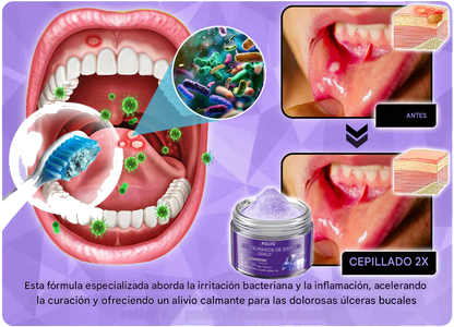 Polvo mineral para la restauración de dientes ODALIT™🦷