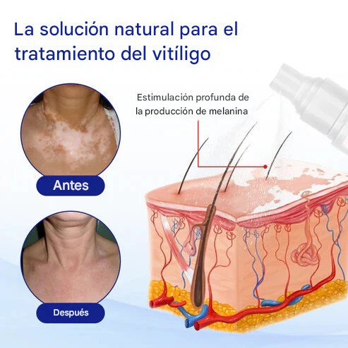 Oveallgo® Evenora Spray de hierbas